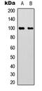 Aconitase 1 antibody, LS-C358895, Lifespan Biosciences, Western Blot image 