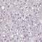Zinc Finger FYVE-Type Containing 26 antibody, HPA055500, Atlas Antibodies, Immunohistochemistry paraffin image 