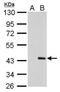 Proline/serine-rich coiled-coil protein 1 antibody, GTX629077, GeneTex, Western Blot image 