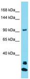 Janus kinase and microtubule-interacting protein 3 antibody, TA337365, Origene, Western Blot image 