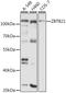 Zinc Finger And BTB Domain Containing 21 antibody, LS-C747863, Lifespan Biosciences, Western Blot image 