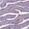 Malate Dehydrogenase 1B antibody, HPA073761, Atlas Antibodies, Immunohistochemistry frozen image 