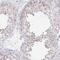 Proline And Serine Rich 3 antibody, PA5-63578, Invitrogen Antibodies, Immunohistochemistry paraffin image 