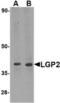Probable ATP-dependent RNA helicase DHX58 antibody, TA306481, Origene, Western Blot image 