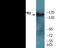 Kinase Insert Domain Receptor antibody, EKC2133, Boster Biological Technology, Western Blot image 
