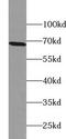 Acyl-CoA Binding Domain Containing 5 antibody, FNab00076, FineTest, Western Blot image 