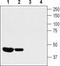Potassium Voltage-Gated Channel Subfamily A Member 10 antibody, TA328637, Origene, Western Blot image 