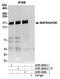 Mitogen-activated protein kinase kinase kinase kinase 4 antibody, A301-503A, Bethyl Labs, Immunoprecipitation image 