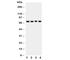 ATP Binding Cassette Subfamily G Member 2 (Junior Blood Group) antibody, R30969, NSJ Bioreagents, Western Blot image 