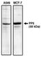 Protein Phosphatase 5 Catalytic Subunit antibody, AP05147PU-N, Origene, Western Blot image 