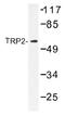 Dopachrome Tautomerase antibody, AP01482PU-N, Origene, Western Blot image 