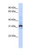 Zinc Finger Protein 705D antibody, orb325581, Biorbyt, Western Blot image 