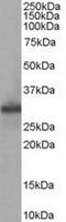 Four And A Half LIM Domains 1 antibody, TA302486, Origene, Western Blot image 