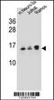 Ubiquitin Conjugating Enzyme E2 E2 antibody, 57-295, ProSci, Western Blot image 