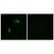 Collagen Type XIV Alpha 1 Chain antibody, PA5-49916, Invitrogen Antibodies, Immunofluorescence image 