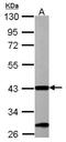 Acetyl-CoA Acyltransferase 1 antibody, NBP2-15233, Novus Biologicals, Western Blot image 