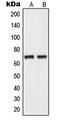 Nei Like DNA Glycosylase 3 antibody, MBS820433, MyBioSource, Western Blot image 