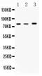 Arachidonate 12-lipoxygenase, 12S-type antibody, PA5-78760, Invitrogen Antibodies, Western Blot image 