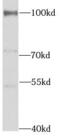 UV Radiation Resistance Associated antibody, FNab09352, FineTest, Western Blot image 