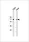 Forkhead box protein N1 antibody, 56-203, ProSci, Western Blot image 