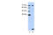 LSM2 Homolog, U6 Small Nuclear RNA And MRNA Degradation Associated antibody, 29-456, ProSci, Immunohistochemistry paraffin image 