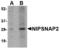 Nipsnap Homolog 2 antibody, MBS150143, MyBioSource, Western Blot image 
