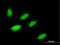 Zinc Finger Protein 653 antibody, H00115950-B01P, Novus Biologicals, Immunocytochemistry image 