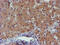Phosphoglucomutase 3 antibody, M02052, Boster Biological Technology, Immunohistochemistry paraffin image 