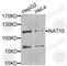 N-Acetyltransferase 10 antibody, A7292, ABclonal Technology, Western Blot image 