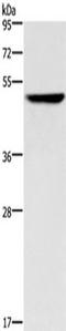 Keratin 16 antibody, TA322577, Origene, Western Blot image 