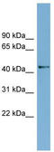 Amidohydrolase Domain Containing 1 antibody, TA338846, Origene, Western Blot image 