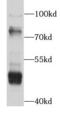 Peroxisomal acyl-coenzyme A oxidase 1 antibody, FNab00095, FineTest, Western Blot image 