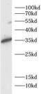 WAP Four-Disulfide Core Domain 2 antibody, FNab10739, FineTest, Western Blot image 