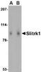 SLIT and NTRK-like protein 1 antibody, NBP1-77319, Novus Biologicals, Western Blot image 