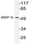 Bone morphogenetic protein 5 antibody, AP20581PU-N, Origene, Western Blot image 