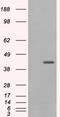 PDZ domain-containing protein GIPC1 antibody, EB06196, Everest Biotech, Western Blot image 