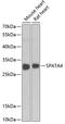 Spermatogenesis-associated protein 4 antibody, A15127-1, Boster Biological Technology, Western Blot image 