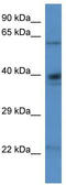 Delta-1-pyrroline-5-carboxylate dehydrogenase, mitochondrial antibody, TA337809, Origene, Western Blot image 