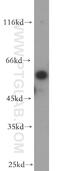 RNA 2',3'-Cyclic Phosphate And 5'-OH Ligase antibody, 19809-1-AP, Proteintech Group, Western Blot image 