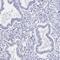 Solute Carrier Family 5 Member 1 antibody, NBP2-33629, Novus Biologicals, Immunohistochemistry paraffin image 