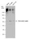 Pancreatic Lipase antibody, GTX109936, GeneTex, Western Blot image 