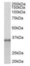 rRNA 2 -O-methyltransferase fibrillarin antibody, orb12317, Biorbyt, Western Blot image 