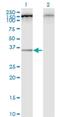 Family With Sequence Similarity 216 Member A antibody, H00029902-M01, Novus Biologicals, Western Blot image 
