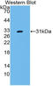 CD109 Molecule antibody, LS-C314786, Lifespan Biosciences, Western Blot image 
