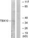 T-Box 10 antibody, TA316385, Origene, Western Blot image 