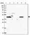 Zinc finger protein 639 antibody, PA5-61864, Invitrogen Antibodies, Western Blot image 