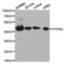 PTPN2 antibody, TA327184, Origene, Western Blot image 