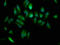 Elongator complex protein 3 antibody, CSB-PA884499LA01HU, Cusabio, Immunofluorescence image 