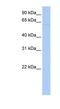 Leucine Rich Repeat Containing 56 antibody, NBP1-70626, Novus Biologicals, Western Blot image 