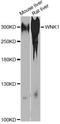 WNK1 antibody, LS-C749207, Lifespan Biosciences, Western Blot image 